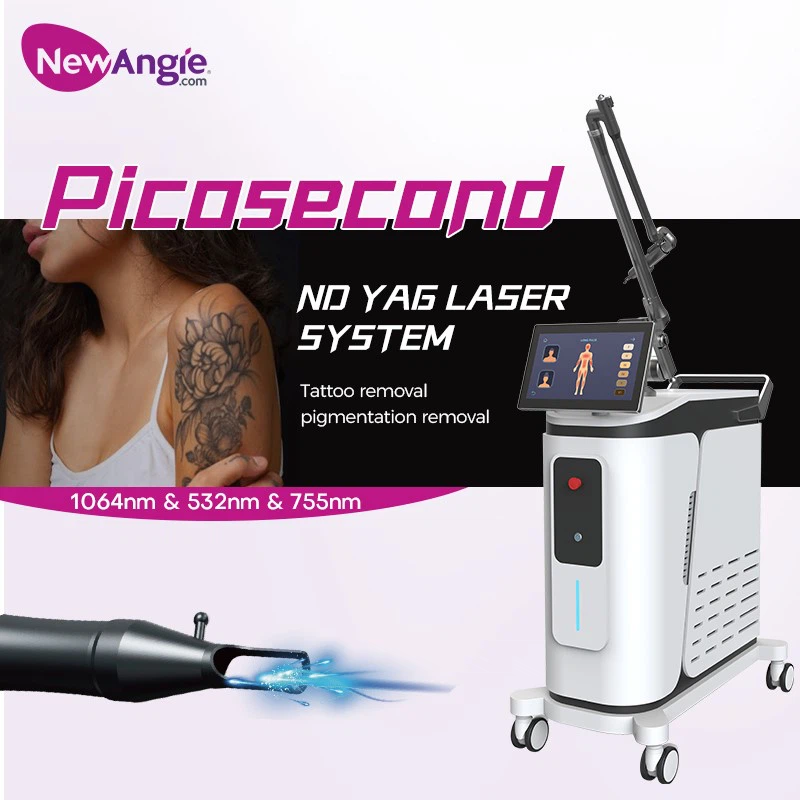 Best Tattoo Removal Equipment 2 Best Tattoo Removal Equipment 2